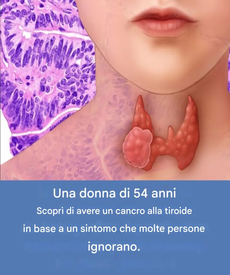 Cancro alla tiroide: un'anomalia apparentemente minore che ha rivelato tutto