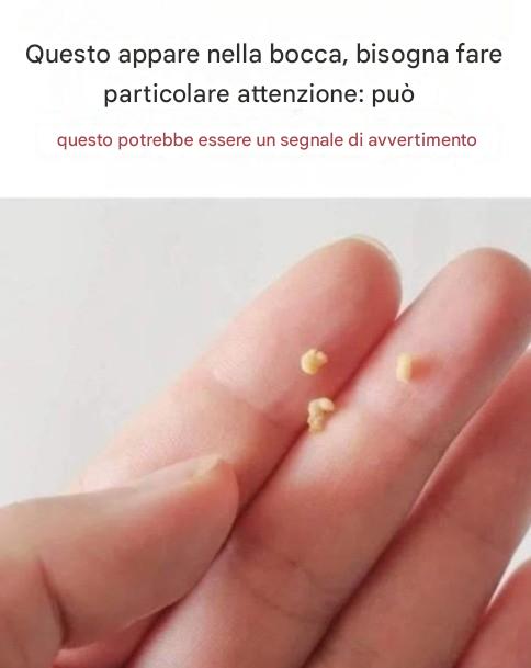 Questo appare nella bocca, fai particolare attenzione: potrebbe essere un segnale di avvertimento