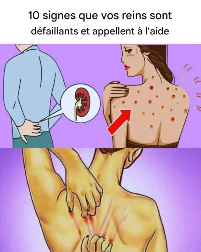 Se i tuoi reni sono in pericolo, il tuo corpo ti mostrerà questi 10 segnali.