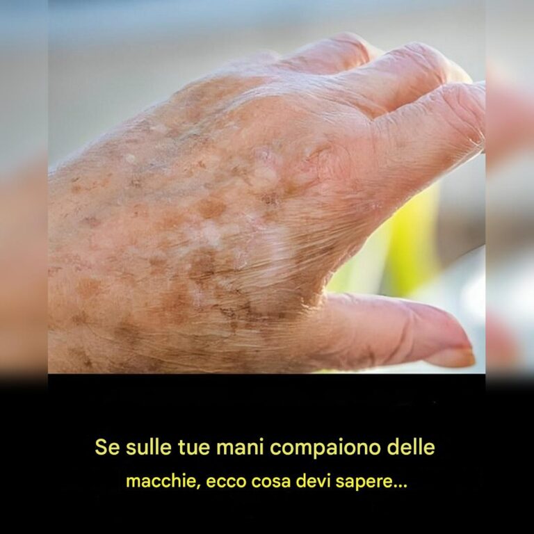Sapevi che se sulle tue mani compaiono delle macchie, è un chiaro segno che…