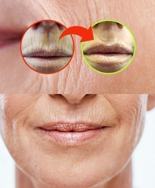 RRUGAS EN LA BOCA, NO HAY QUE PERDER TIEMPO CON CREMAS: LA CURA ESTÁ EN LA DESPENSA