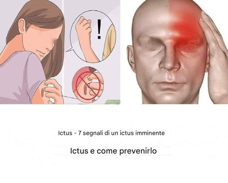 Un mese prima di un AVC, il tuo corpo è in anticipo: 10 segni da non ignorare
